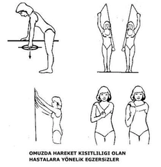 Omuz Kireçlenmesi Egzersizleri Nasıl Yapılır?